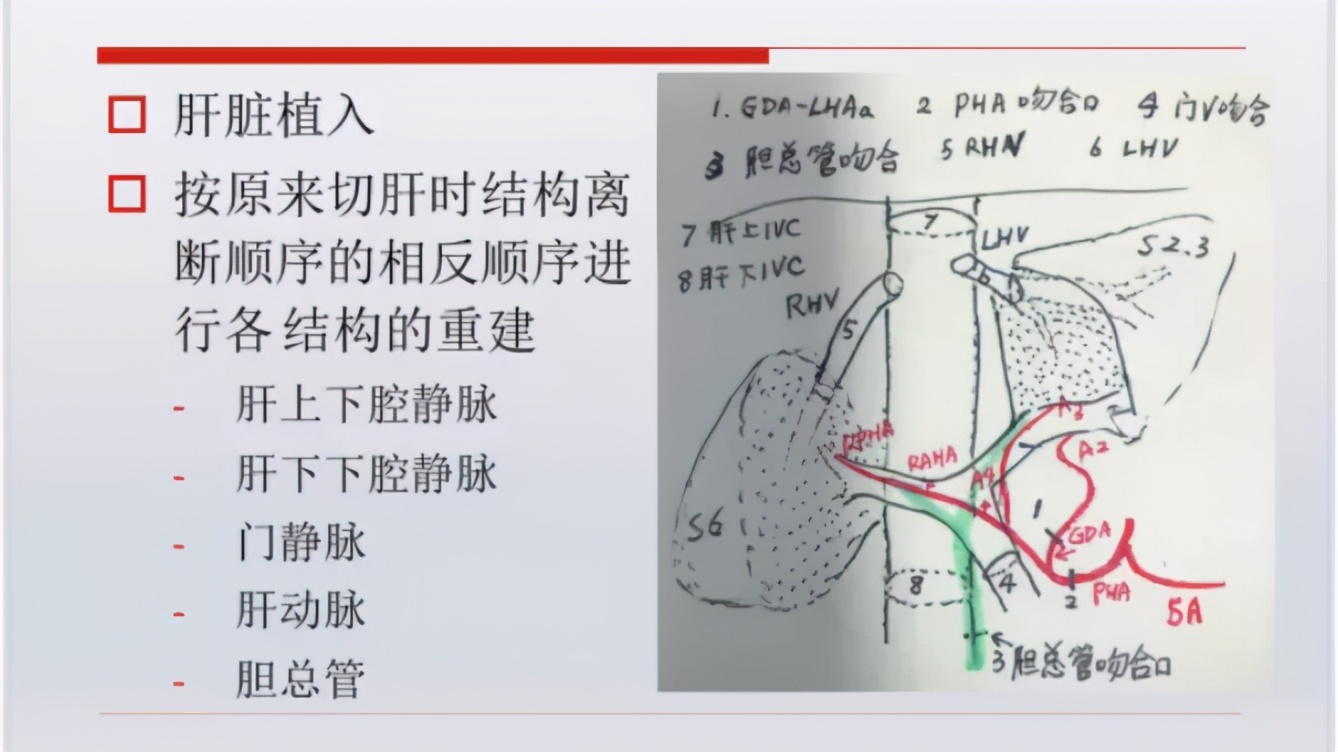 把肝脏取出来,把肝取出来会怎么样