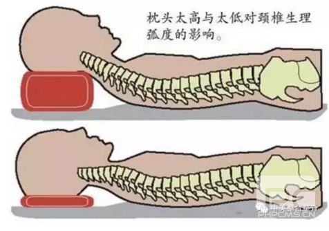 生理曲度变直是怎么回事,生理弧度消失呈反曲怎么回事