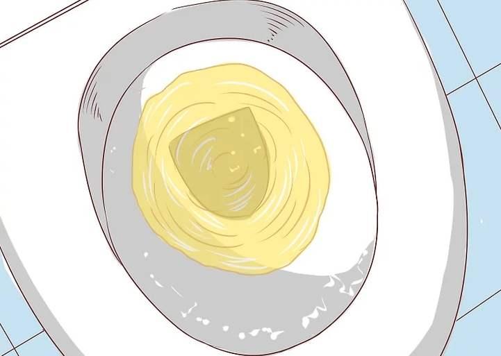 泡沫尿已达10年,泡沫尿意味着什么病