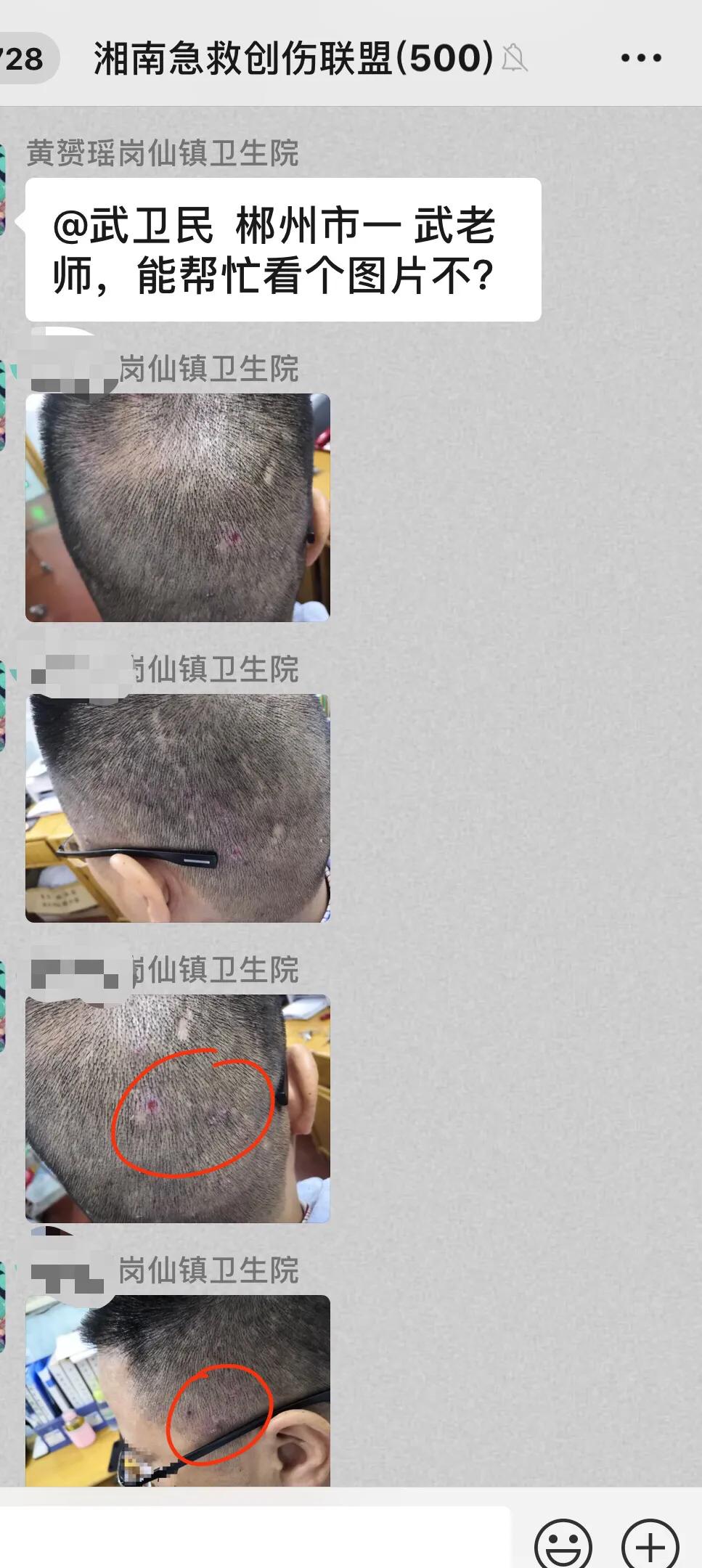 小伤口原唱完整版,小创伤解除大痛苦