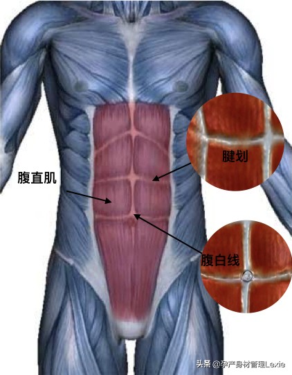 产后腹直肌分离怎么瘦肚子,产后腹直肌分离肚子松松垮垮