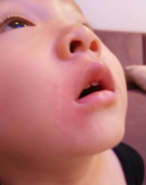 孩子经常发火,是脾气不好还是心火?