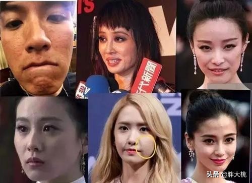 彻底去闭口的最佳方法,去闭口的好物有哪些