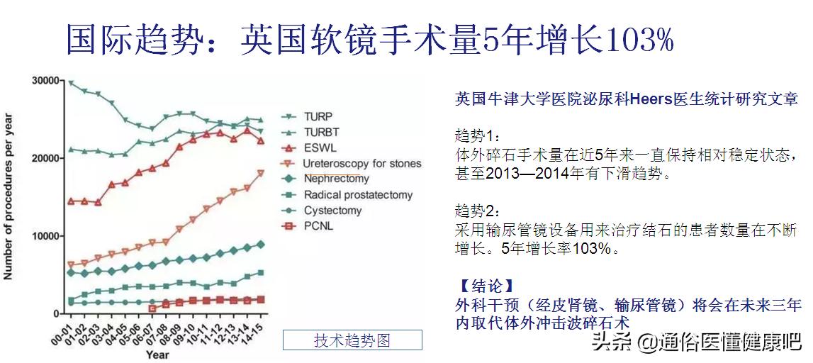 体外碎石冲击波与超声波哪个好,体外冲击波碎石与微创碎石哪个好