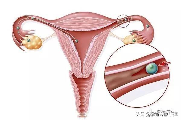 于萍主任青岛,助孕专家于萍讲述