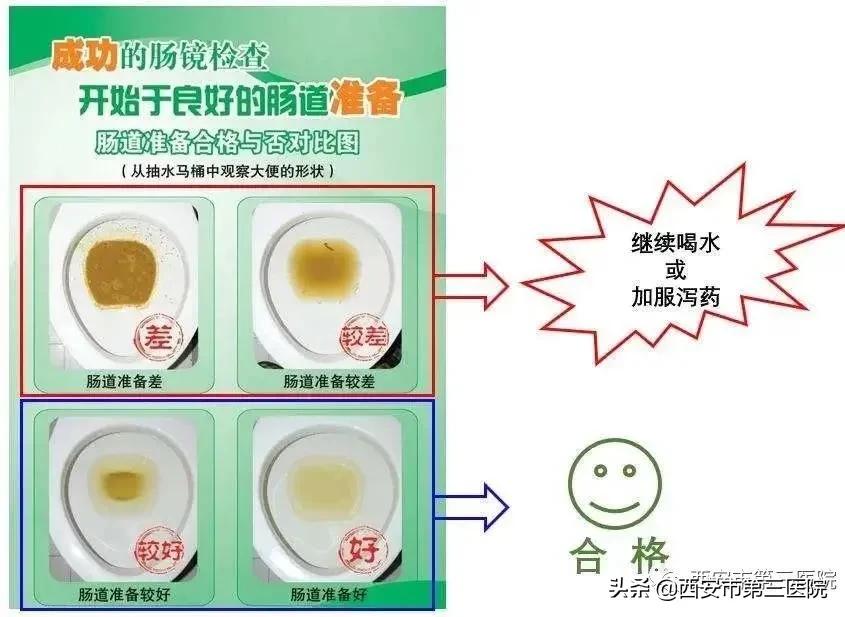 做肠镜是不是特受罪,做肠镜是不是很遭罪