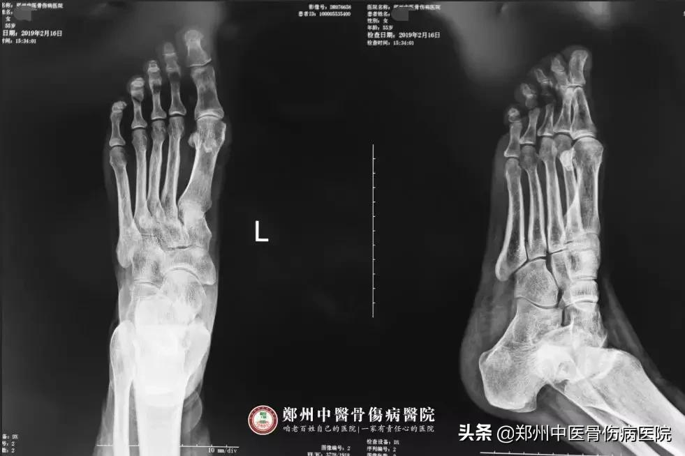 她辗转多家医院治疗未见好转，终在这里成功解除病痛！