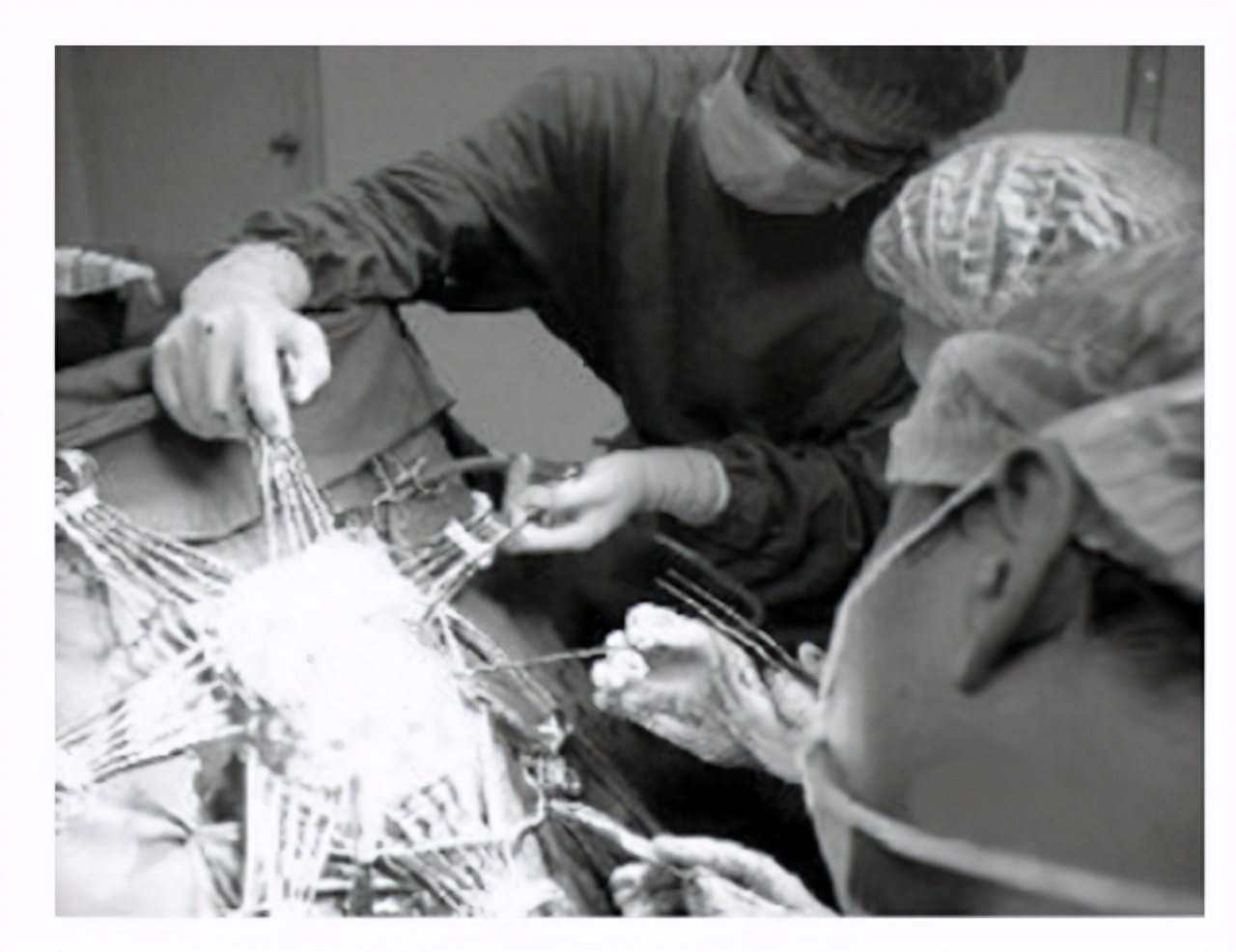 乳腺囊肿和结节哪一个容易癌变,乳腺囊肿在怀孕期会癌变吗