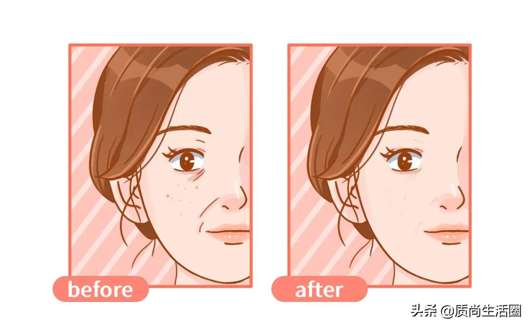 家用热玛吉美容仪多久做一次合适,热玛吉美容仪自己做