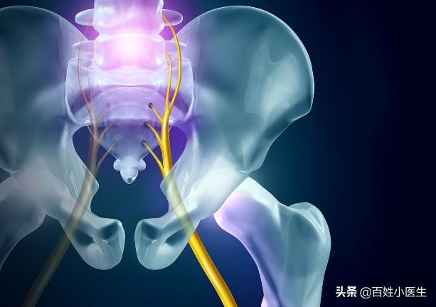 坐骨神经腿部按摩手法全部过程,腰椎狭窄压迫坐骨神经痛能按摩吗