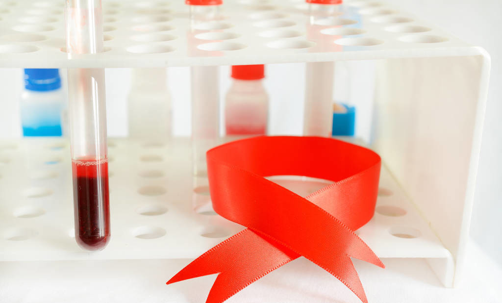 怎么知道自己的腺肌症是轻还是重,怎么判断腺肌症是轻度还是重度