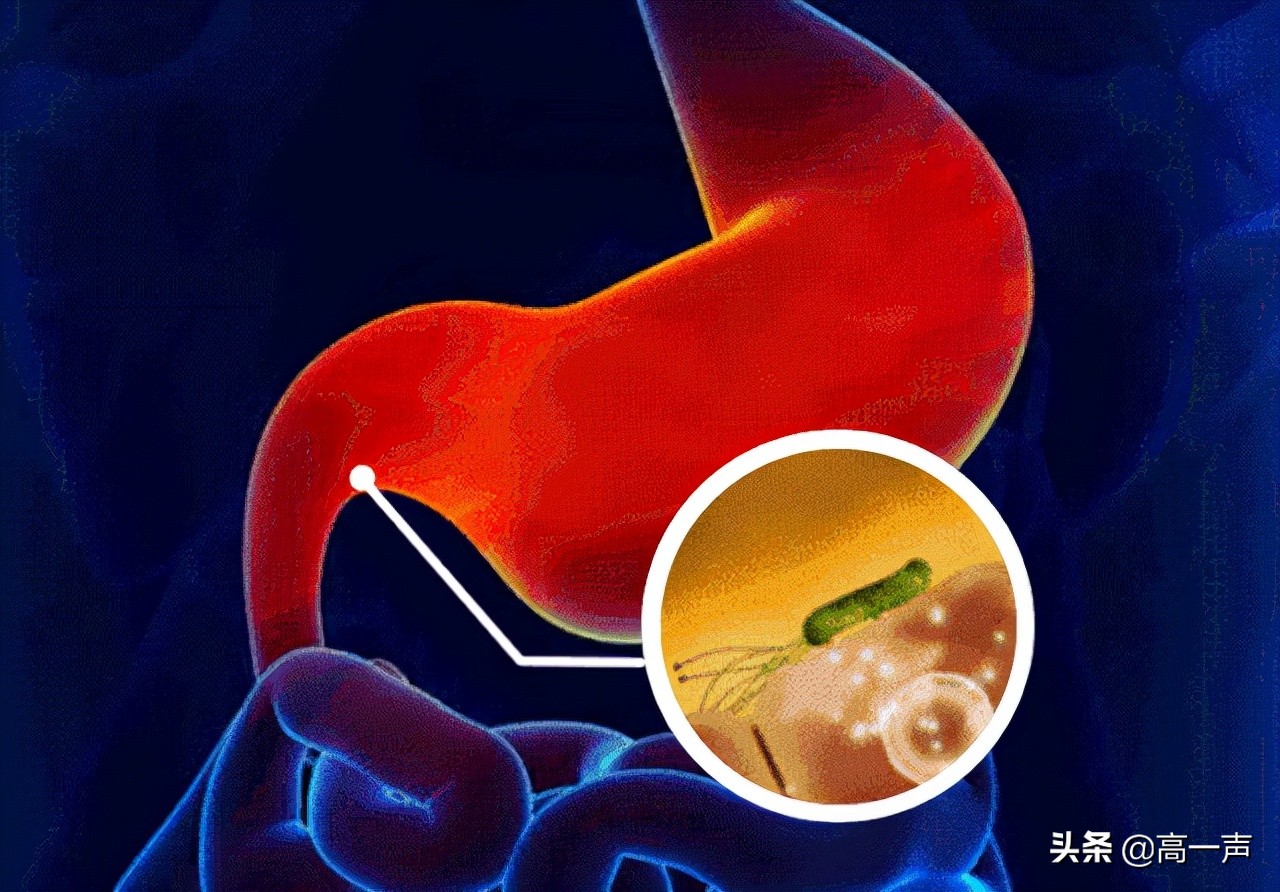 慢性胃炎要注意哪些事情,慢性胃炎要注意什么事项