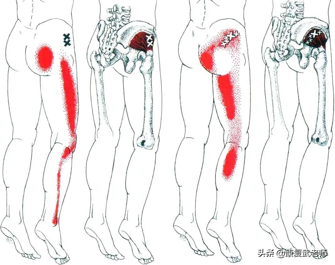臀部肌群解剖,臀部肌功能解剖
