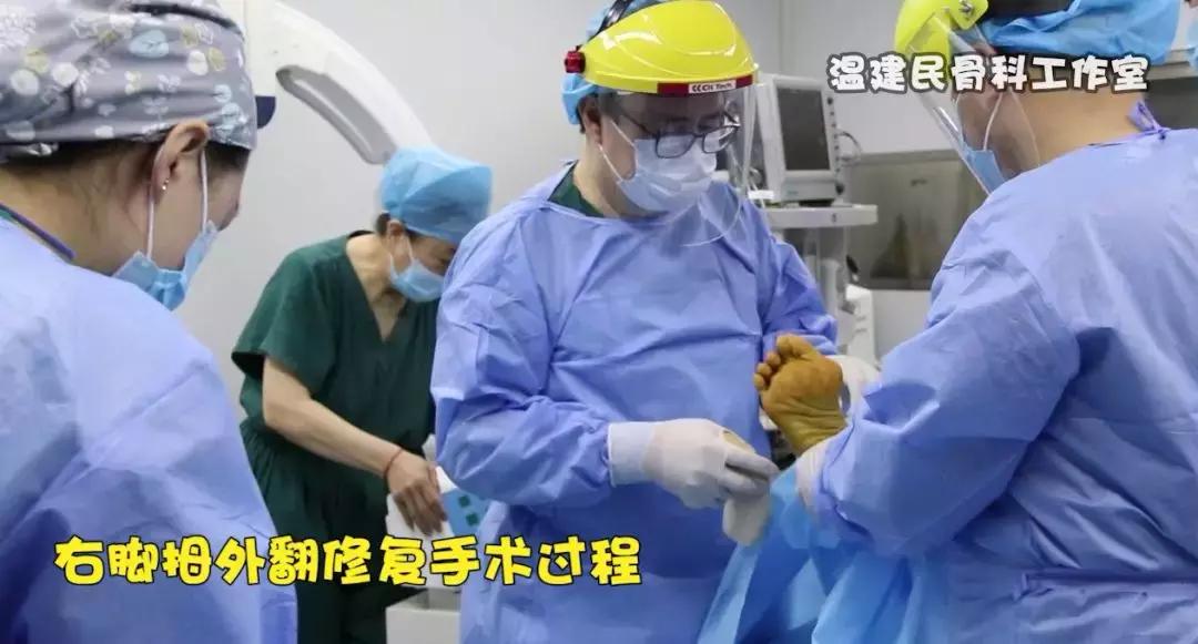 71岁患者为治拇外翻被切脚趾，畸形疼痛更严重！重修后终于不疼了
