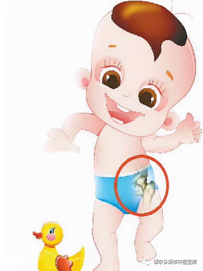 小儿髋关节发育不良都做什么检查,小儿髋关节发育不良超声