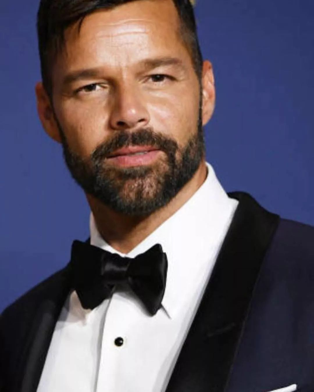 RickyMartin的粉丝希望他去做微针治疗改善皮肤