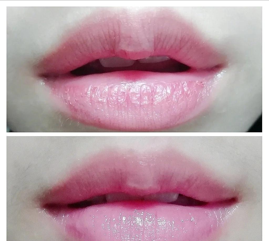 嘴唇好丑怎么变好看,嘴唇为何会越变越难看