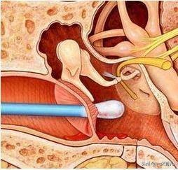 小孩的耳朵怎么护理,宝宝耳朵有异物医生怎么洗