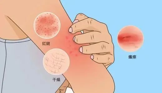 全自动洗衣机太脏能引起皮肤痒吗,洗衣机太脏导致皮肤过敏怎么办