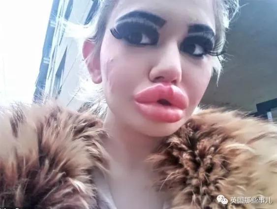 20次丰唇,20次整容成功的女人