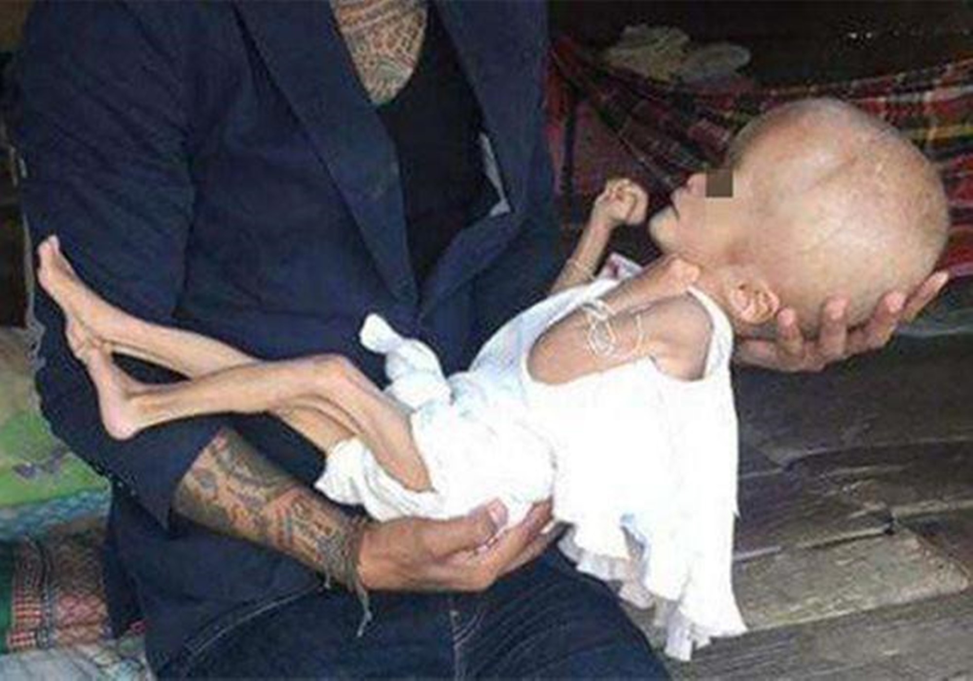 以前喝过三鹿奶粉的孩子怎么样了,当年喝了三鹿奶粉的孩子咋样了