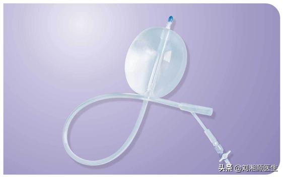 免疫治疗不良妊娠的方法,宫腔粘连合并妊娠