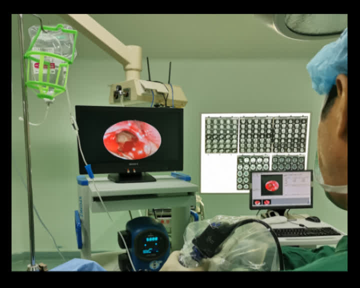 鼻子不舒服眼睛模糊怎么回事,鼻子干燥眼睛看东西模糊怎么回事