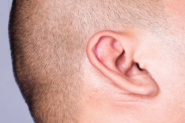 油耳朵就一定有狐臭吗几岁会有,油耳朵孩子会在几岁开始出现狐臭