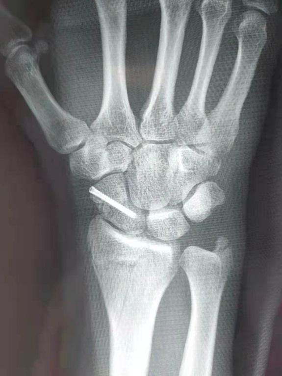 德国骨科医生对中国的评价,德国人评价中国骨科