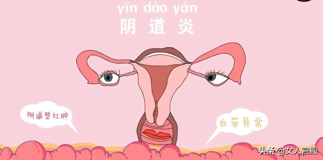 炎症——女性克星,你怕了吗?