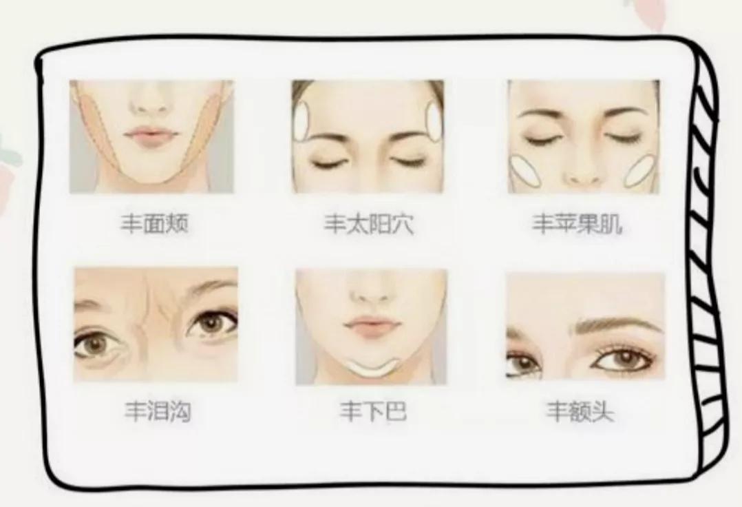 面部脂肪填充术后注意事项,脂肪填充成包子脸怎么修复