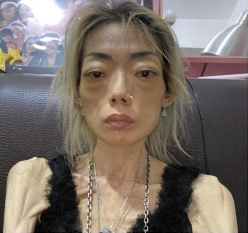 被豪门抛弃：昔日的22岁嫩模为取悦丈夫吃*肥药减**竟瘦成“纸片人”