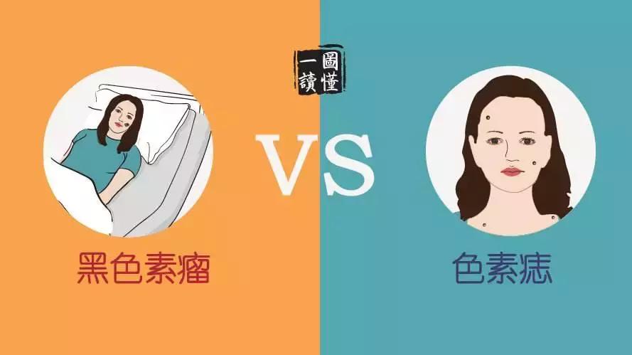 人身上长的黑痣瘊子能变癌症吗,手上长小黑痣会是癌症信号吗