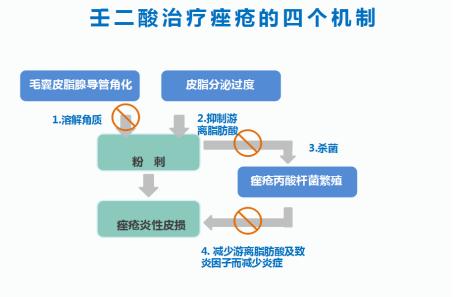 壬二酸对什么样的痘痘有效,壬二酸会让粉刺变多吗