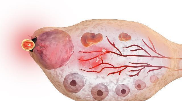 备孕如何抓准排卵期,备孕期该怎么监测排卵