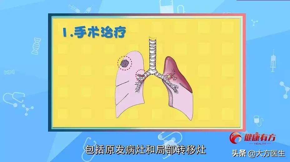 肺癌脑转移有没有治疗手段,中央型肺癌的治疗手段