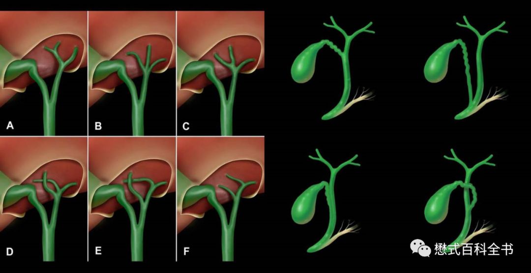 开展mrcp技术,mrcp检查操作流程