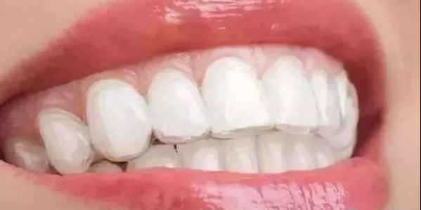 正畸价格会下降吗,正畸矫正为啥这么贵