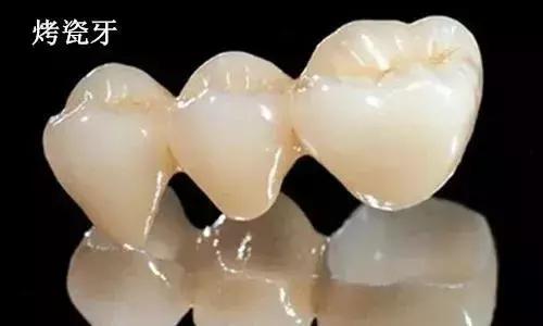 怎么才能真正有效的美白牙齿,最快最有效美白牙齿的方法