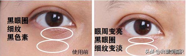 雅诗兰黛眼霜去细纹效果怎么样,雅诗兰黛祛眼纹吗