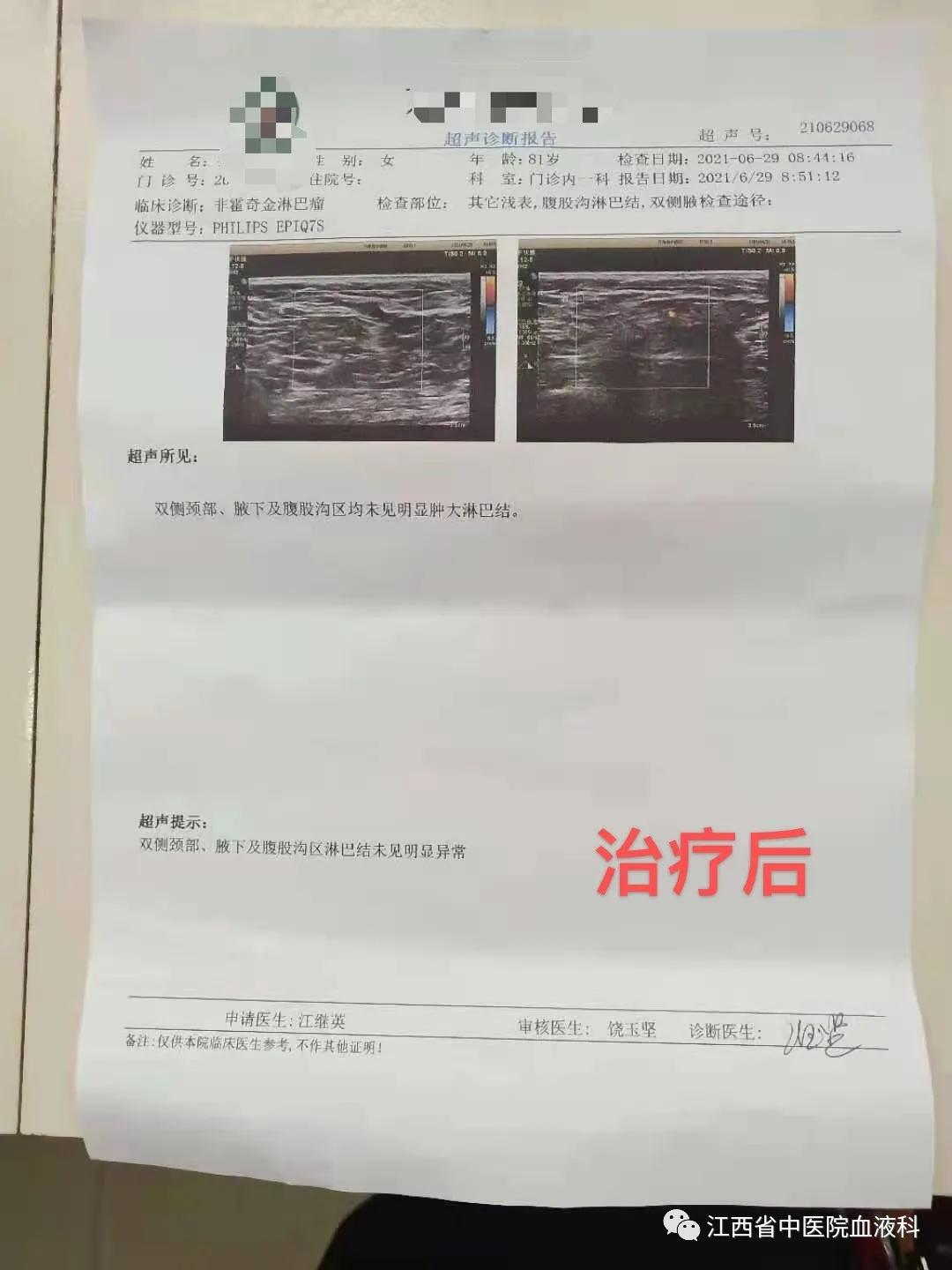 老人淋巴瘤保守治疗西医怎么治,中西医结合治愈多发性骨髓瘤