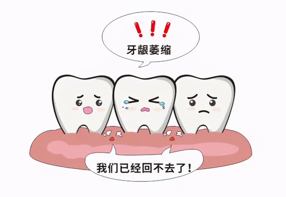 【科普】中年焦虑，我的牙齿怎么“变长”了？