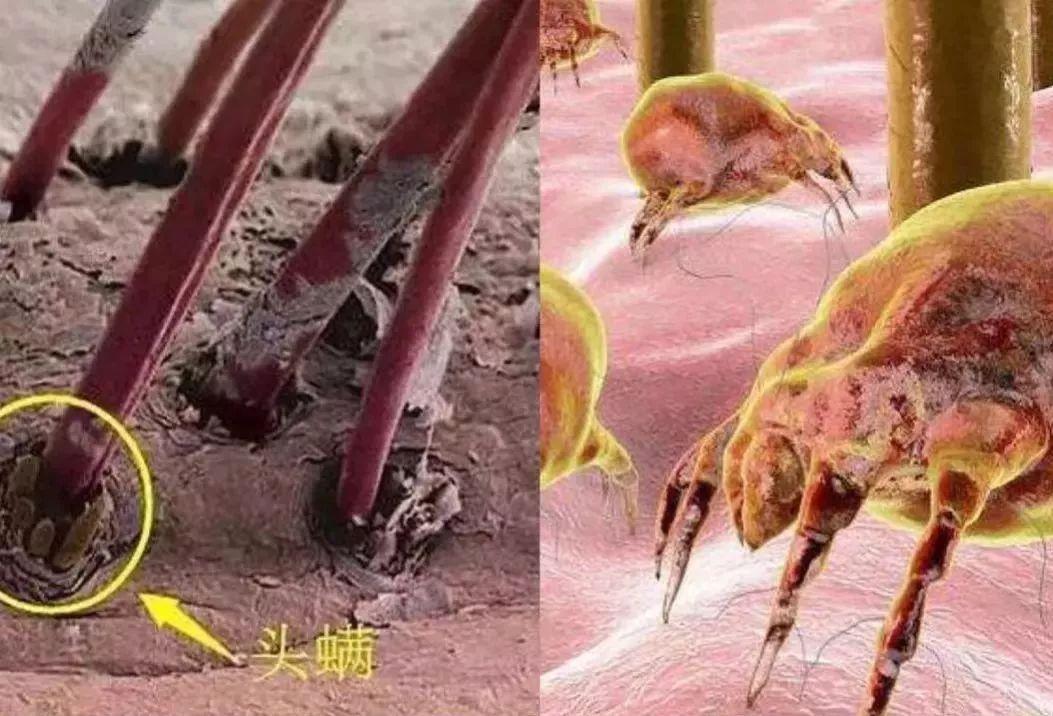 如何用显微镜观察头发,头发抠出来白色污垢是什么