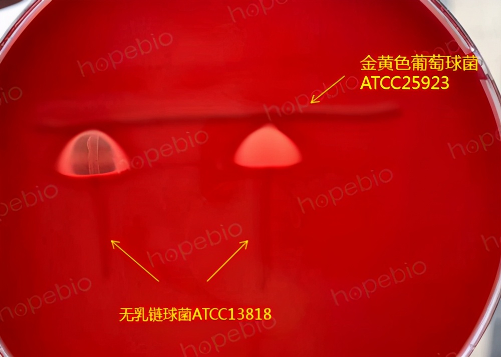 细菌溶血现象的原理,细菌革兰染色实验报告