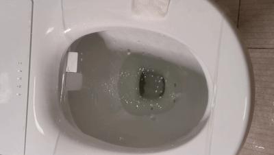 舒服如厕的正确打开方式,如厕通畅小妙招