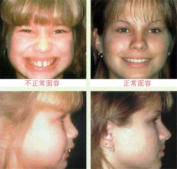 儿子越长越像大猩猩,长得像大猩猩的脸型