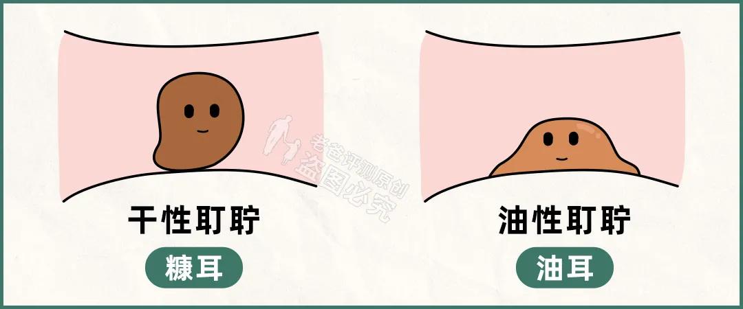 耳屎可以经常掏耳朵吗,掏耳屎的危害有多大