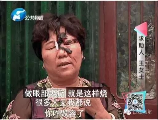 被美容院害烂脸,被美容院害惨了的女人
