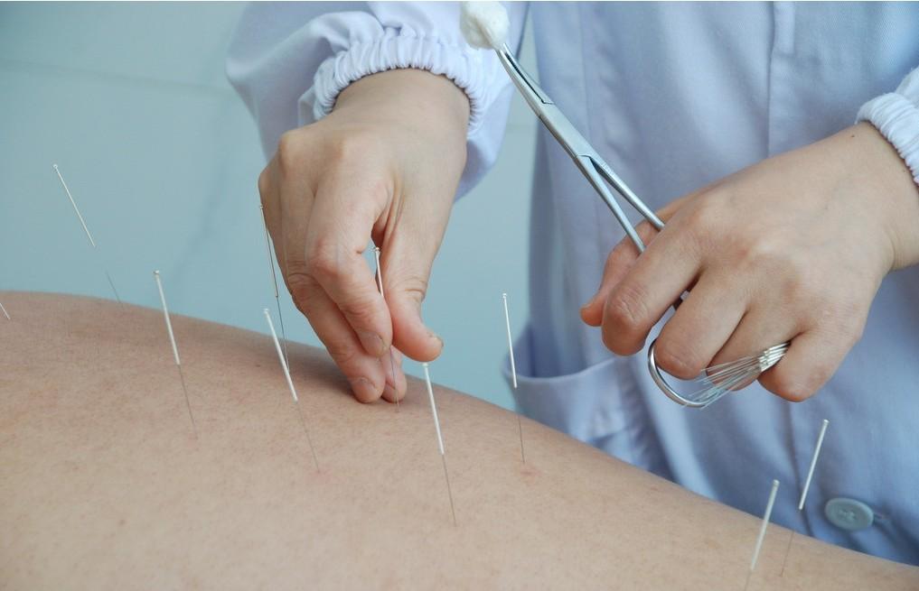 中医治疗复发性流产的优势——下篇