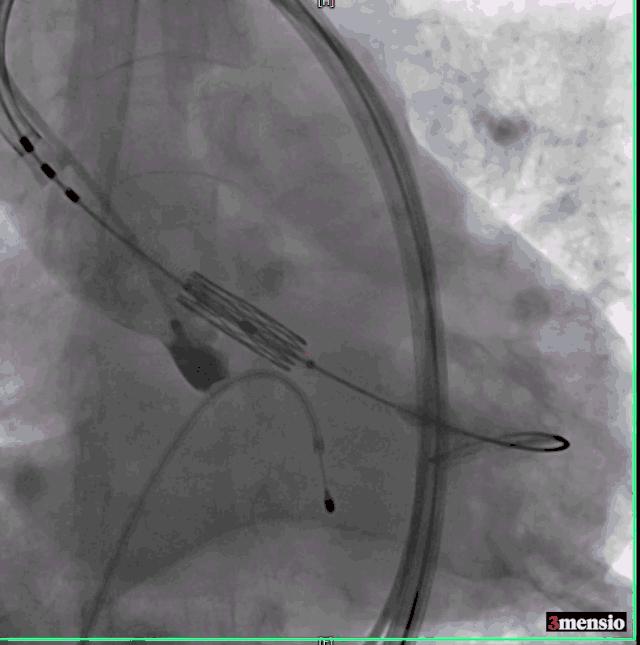 罗建方医生怎么样,罗建方教授